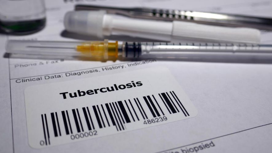 tuberculosis printed above barcode